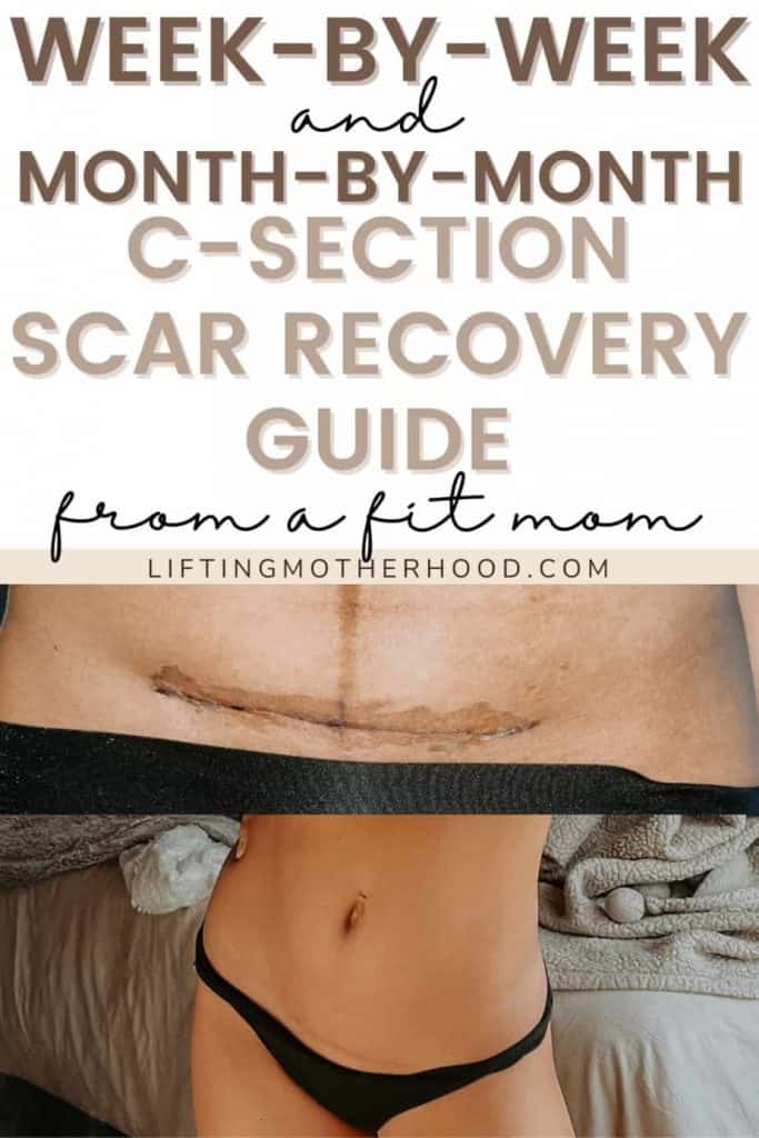 c-section-scar-recovery-pin
