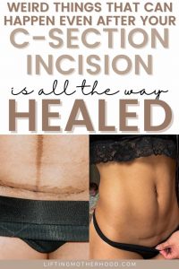 10 Things About Your Healed C Section Incision | Lifting Motherhood